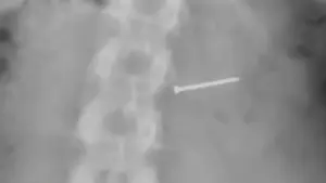 Bồi thường 14 triệu USD vì bán kem lẫn đinh sắt