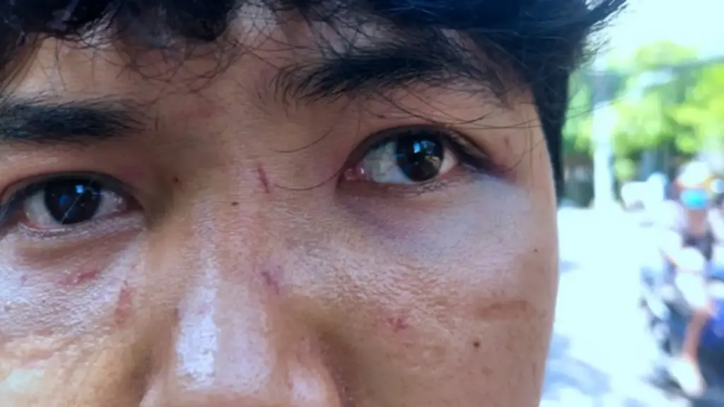 Hành hung người bán bánh bèo ở Quy Nhơn: Con trai cũng bị đánh