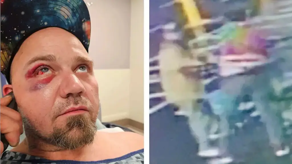 Kẻ trộm kiện ngược nhân viên siêu thị vì bị đuổi đánh